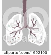 Poster, Art Print Of Green Lungs Damage Tree Illustration