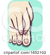 Foot Itchy Illustration