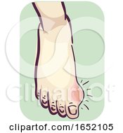 Poster, Art Print Of Foot With Gout