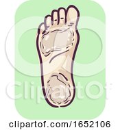 Foot Symptom Thicken Skin Illustration