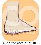 Poster, Art Print Of Foot Thick Dry Skin Illustration