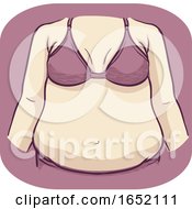 Girl Symptom Increase Abdominal Fat Illustration