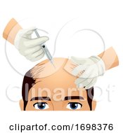 Poster, Art Print Of Man Head Hair Injection Illustration