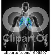 Poster, Art Print Of 3d Medical Image Showing Male With Virus Cells In His Lungs