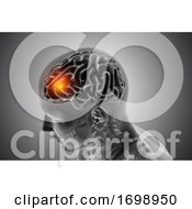 Poster, Art Print Of 3d Male Medical Figure With Front Of The Brain Highlighted