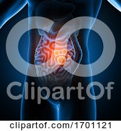 Poster, Art Print Of 3d Male Medical Figure Showing Virus Cells In The Guts