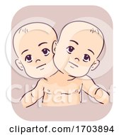Poster, Art Print Of Kids Boys Conjoined Twins Illustration
