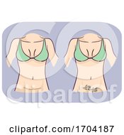 Girl Body Tattoo Scar Cover Up Illustration