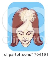 Girl Female Pattern Baldness Top Area Illustration