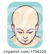 Poster, Art Print Of Man Bald Full Head Hair Loss Illustration