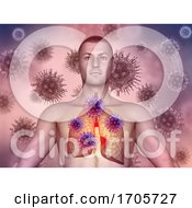 Poster, Art Print Of 3d Medical Image With Male Figure With Virus Cells Attacking The Lungs