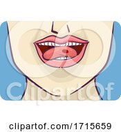 Symptom Red Blood Blister Side Tongue Illustration