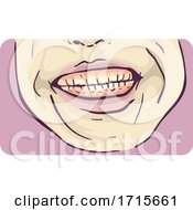 Poster, Art Print Of Symptom Teeth Grinding Illustration