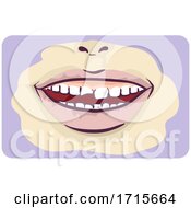 Poster, Art Print Of Symptoms Chipped Tooth Illustration