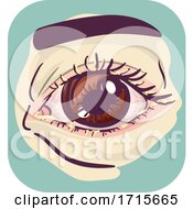 Poster, Art Print Of Symptoms Crusty Eye Illustration