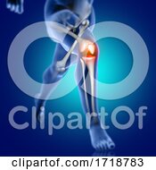3D Male Medical Figure Running With Knee Bone Highlighted