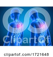 Poster, Art Print Of 3d Medical Background Showing Good And Poor Posture With Spine Highlighted