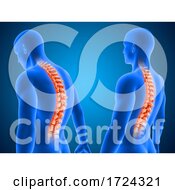 3D Medical Background Showing Correct And Poor Posture With Spine Highlighted
