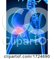 Poster, Art Print Of 3d Medical Image Of Skeleton With Hip Bone Highlighted