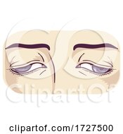 Poster, Art Print Of Eye Muscles Weakness Control Illustration