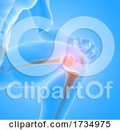 Poster, Art Print Of 3d Male Medical Figure With Close Up Of Knee Bones