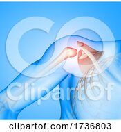 Poster, Art Print Of 3d Male Medical Figure With Shoulder Socket Highlighted
