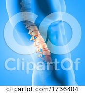 Poster, Art Print Of 3d Male Medical Figure With Spine Highlighted