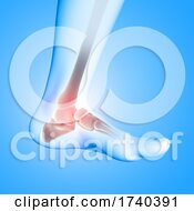 Poster, Art Print Of 3d Medical Image Of Ankle Bone