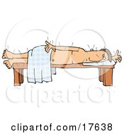 Male Caucasian Patient Poked All Over With Acupuncture Needles Lying On His Side On A Table While Draped In A Sheet Clipart Illustration by djart