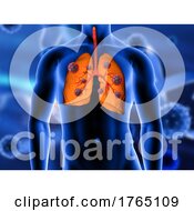 Poster, Art Print Of 3d Medical Background With Close Up Of Lungs Being Attacked By Covid 19 Virus Cells
