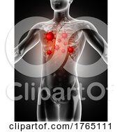 Poster, Art Print Of 3d Medical Image Showing Virus Cells In Lung Area