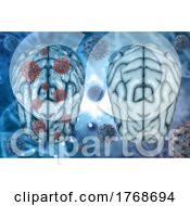 Poster, Art Print Of 3d Medical Background Of Healthy Brain And Diseased Brain With Covid 19 Virus Cells