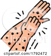 Hand With Allergy Spots