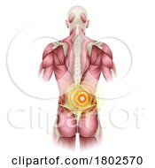 Poster, Art Print Of Lower Back Pain Medical Anatomy Illustration
