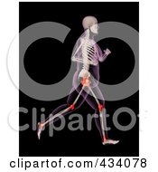 An Xray Of An Overweight Female Skeleton Running With Pressure Points