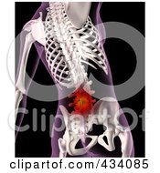 Royalty Free RF Clipart Illustration Of An Xray Of A Female Skeleton With Lower Back Pain