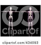 Royalty Free RF Clipart Illustration Of A Digital Collage Of Thin And Overweight Female Skeletons