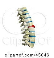 Human Spine With A Red Injured Spinal Disc