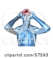 Royalty Free RF Clipart Illustration Of A 3d Blue Body Character With A Migraine Version 4 by Julos