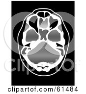 Royalty Free RF Clipart Illustration Of A Black And White CT Scan