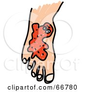 Royalty Free RF Clipart Illustration Of A Foot With Orange Germs