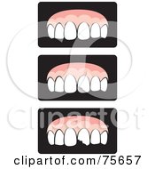 Royalty Free RF Clipart Illustration Of A Digital Collage Of Healthy And Decaying Teeth