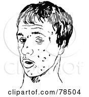 Royalty Free RF Clipart Illustration Of A Black And White Tenage Boy Face With Zits by Prawny